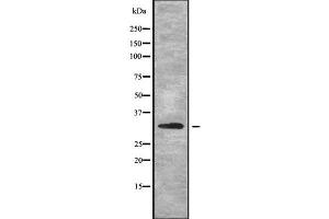 Western blot analysis of MRPL2 using HuvEc whole cell lysates (MRPL2 antibody  (C-Term))