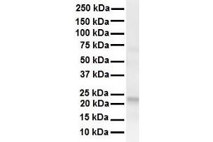 WB Suggested Anti-TMED1 antibody Titration: 1 ug/mL Sample Type: Human liver (TMED1 antibody  (Middle Region))