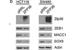 Validation of three novel ZFP36 target genes involved in EMT(Panel A) Boxplot of Log 2 expression values of MACC1, SOX9 and ZEB1 in 23 normal colon mucosa (Normal), 30 primary colon carcinoma (CRC) and 27 liver metastases (Mts) samples. (SOX9 antibody  (AA 121-220))