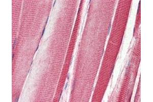 Immunohistochemical analysis of paraffin-embedded human skeletal musle tissues using DDR2 mouse mAb. (DDR2 antibody)