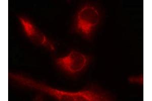Immunofluorescence staining of methanol-fixed Hela cells using Tau(Phospho-Ser356) Antibody. (MAPT antibody  (pSer356))