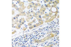 Immunohistochemistry (Paraffin-embedded Sections) (IHC (p)) image for anti-Glutamate Dehydrogenase 1 (GLUD1) (AA 54-240) antibody (ABIN6141157)