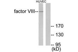 Western blot analysis of extracts from HuvEc cells, using Factor VIII Antibody. (Factor VIII antibody  (AA 2161-2210))