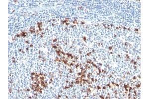 Image no. 2 for Mouse anti-Human kappa Light Chain antibody (ABIN6174183) (Mouse anti-Human kappa Light Chain Antibody)