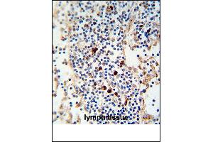 Kappa light chain Antibody (ABIN1539833 and ABIN2843812) immunohistochemistry analysis in formalin fixed and paraffin embedded human lymph tissue followed by peroxidase conjμgation of the secondary antibody and DAB staining. (kappa Light Chain antibody)