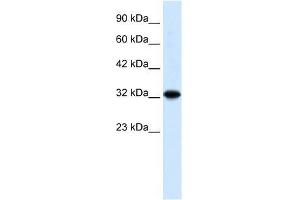 ZBTB32 antibody used at 0. (ZBTB32 antibody  (N-Term))