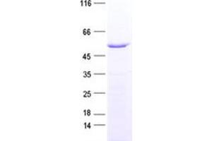Validation with Western Blot (DCAF12 Protein (His tag))
