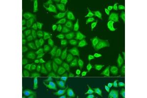 Immunofluorescence analysis of U2OS cells using CAPZB Polyclonal Antibody at dilution of 1:100. (CAPZB antibody)