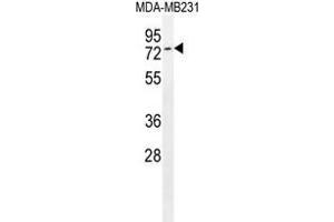 Tiparp Antibody (C-term) western blot analysis in MDA-MB231 cell line lysates (35 µg/lane). (Tiparp antibody  (C-Term))