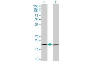 Western Blot analysis of PTH expression in transfected 293T cell line by PTH monoclonal antibody (M18), clone 3C2. (PTH antibody  (AA 32-115))