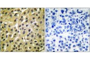 Immunohistochemistry (IHC) image for anti-Mdm2, p53 E3 Ubiquitin Protein Ligase Homolog (Mouse) (MDM2) (AA 391-440) antibody (ABIN1533341)