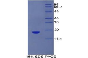 SDS-PAGE (SDS) image for alpha-2-Glycoprotein 1, Zinc-Binding (AZGP1) (AA 178-307) protein (His tag) (ABIN2120505)