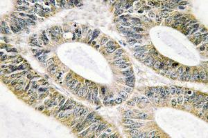 Immunohistochemistry analysis of Galectin-9 antibody . (Galectin 9 antibody)