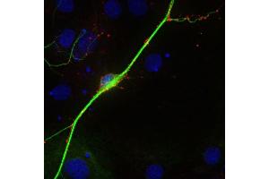 Indirect immunostaining of PFA fixed rat hippocampus neurons with anti-synaptoporin (1 : 500; red) and mouse anti-MAP 2 (cat. (Synaptoporin antibody)