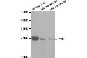 Western blot analysis of extracts of various cell lines, using LY96 antibody (ABIN5970959) at 1/1000 dilution. (LY96 antibody)