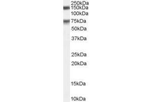 Western Blotting (WB) image for Maternal Embryonic Leucine Zipper Kinase (MELK) peptide (ABIN370227)