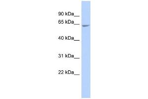 GALNTL4 antibody used at 1 ug/ml to detect target protein. (UDP-N-Acetyl-alpha-D-Galactosamine:polypeptide N-Acetylgalactosaminyltransferase 18 (GALNT18) (Middle Region) antibody)