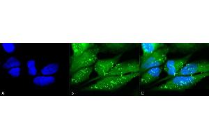 Immunocytochemistry/Immunofluorescence analysis using Rabbit Anti-p38 Polyclonal Antibody (ABIN361847 and ABIN361848). (MAPK14 antibody)