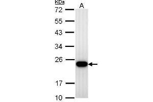 WB Image Transgelin antibody detects TAGLN protein by Western blot analysis. (Transgelin antibody)