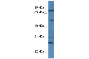 Human HCT15; WB Suggested Anti-GOLGA1 Antibody Titration: 0.