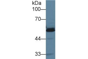 Western Blotting (WB) image for anti-Angiotensinogen (serpin Peptidase Inhibitor, Clade A, Member 8) (AGT) (AA 23-477) antibody (ABIN7432628)