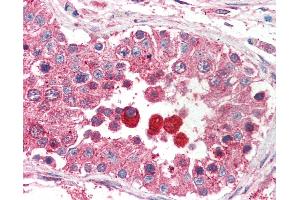 Anti-EIF3M / PCID1 antibody IHC of human testis. (Eukaryotic Translation Initiation Factor 3, Subunit M (EIF3M) (AA 355-366) antibody)