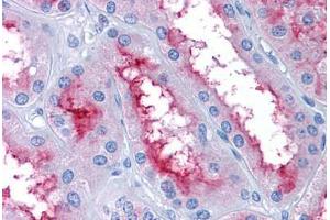 Human Kidney: Formalin-Fixed, Paraffin-Embedded (FFPE) (GCC2 antibody  (AA 1174-1185))