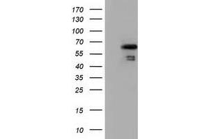 HEK293T cells were transfected with the pCMV6-ENTRY control (Left lane) or pCMV6-ENTRY NUMB (Right lane) cDNA for 48 hrs and lysed. (NUMB antibody)