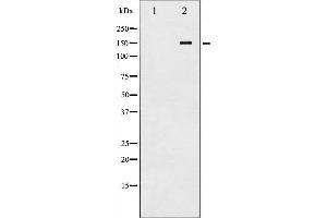 Western blot analysis of Met phosphorylation expression in HepG2 whole cell lysates,The lane on the left is treated with the antigen-specific peptide. (c-MET antibody  (pTyr1234))