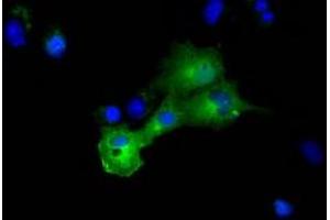 Anti-DYNC1LI1 mouse monoclonal antibody (ABIN2452966) immunofluorescent staining of COS7 cells transiently transfected by pCMV6-ENTRY DYNC1LI1 (RC222010). (DYNC1LI1 antibody)