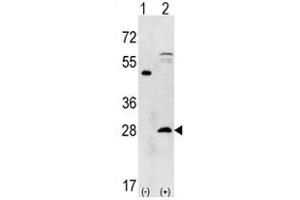 Image no. 1 for anti-Proteasome Subunit alpha 5 (PSMA5) (N-Term) antibody (ABIN356944) (PSMA5 antibody  (N-Term))