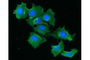 ICC/IF analysis of FABP1 in Hep3B cells line, stained with DAPI (Blue) for nucleus staining and monoclonal anti-human FABP1 antibody (1:100) with goat anti-mouse IgG-Alexa fluor 488 conjugate (Green). (FABP1 antibody)