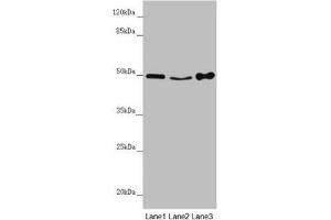 Western blot All lanes: MYLIP antibody at 4. (MYLIP antibody  (AA 266-445))