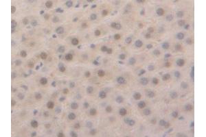 Used in DAB staining on fromalin fixed paraffin-embedded Liver tissue (GSTa5 antibody  (AA 1-221))
