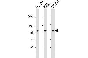 All lanes : Anti-GEN1 Antibody (N-term) at 1:2000 dilution Lane 1: HL-60 whole cell lysate Lane 2: K562 whole cell lysate Lane 3: MCF-7 whole cell lysate Lysates/proteins at 20 μg per lane. (GEN1 antibody  (N-Term))