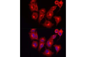 Immunofluorescence (IF) image for anti-Inositol Polyphosphate-5-Phosphatase K (INPP5K) (AA 149-448) antibody (ABIN6142473)