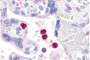 Human Neutrophils: Formalin-Fixed, Paraffin-Embedded (FFPE) (TLR4 antibody  (C-Term))