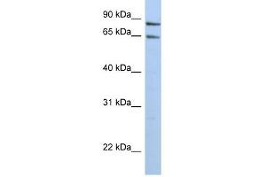 PPP1R10 antibody used at 1 ug/ml to detect target protein.