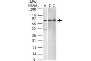 Western blot analysis of 30 ug of total cell lysate from A) Daudi, B) HeLa, and C) mouse NIH/3T3 cells. (IKBKB antibody)