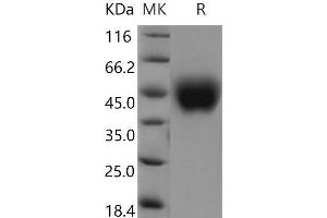 FCRL1 Protein (AA 1-204) (His tag)