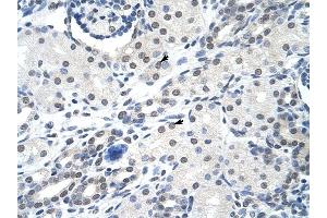 SNRPA antibody was used for immunohistochemistry at a concentration of 4-8 ug/ml to stain Epithelial cells of renal tubule (arrows) in Human Kidney. (SNRPA1 antibody  (Middle Region))