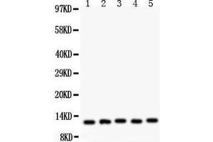 Anti- MIF Picoband antibody, Western blotting All lanes: Anti MIF  at 0. (MIF antibody  (AA 2-115))