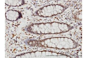 Immunoperoxidase of monoclonal antibody to WDR20 on formalin-fixed paraffin-embedded human colon. (WDR20 antibody  (AA 1-569))