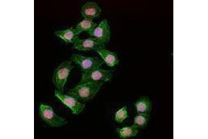 Immunofluorescence (IF) image for anti-Poly (ADP-Ribose) Polymerase 1 (PARP1) antibody (ABIN2666361) (PARP1 antibody)