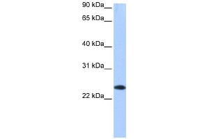WB Suggested Anti-EGLN3 Antibody Titration: 0. (EGLN3 antibody  (C-Term))