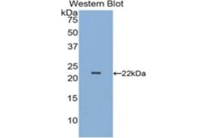 Detection of Recombinant PARK7, Human using Polyclonal Antibody to Parkinson Disease Protein 7 (PARK7) (PARK7/DJ1 antibody  (AA 1-189))