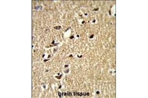 Formalin-fixed and paraffin-embedded human brain tissue reacted with SDCCAG33 Antibody (Center), which was peroxidase-conjugated to the secondary antibody, followed by DAB staining. (TSHZ1 antibody  (AA 656-685))