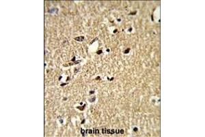 Formalin-fixed and paraffin-embedded human brain tissue reacted with SDCCAG33 Antibody (Center), which was peroxidase-conjugated to the secondary antibody, followed by DAB staining. (TSHZ1 antibody  (AA 656-685))