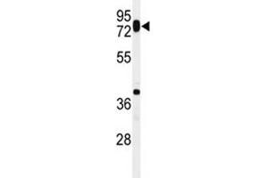 Western blot analysis of HAS1 antibody in ZR-75-1 lysate. (HAS1 antibody  (AA 166-193))