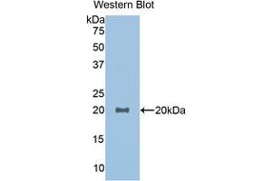 Western blot analysis of the recombinant protein. (GDF1 antibody  (AA 183-357))